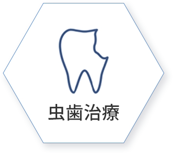 虫歯治療