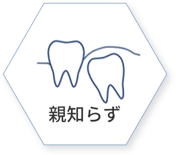 親知らず治療