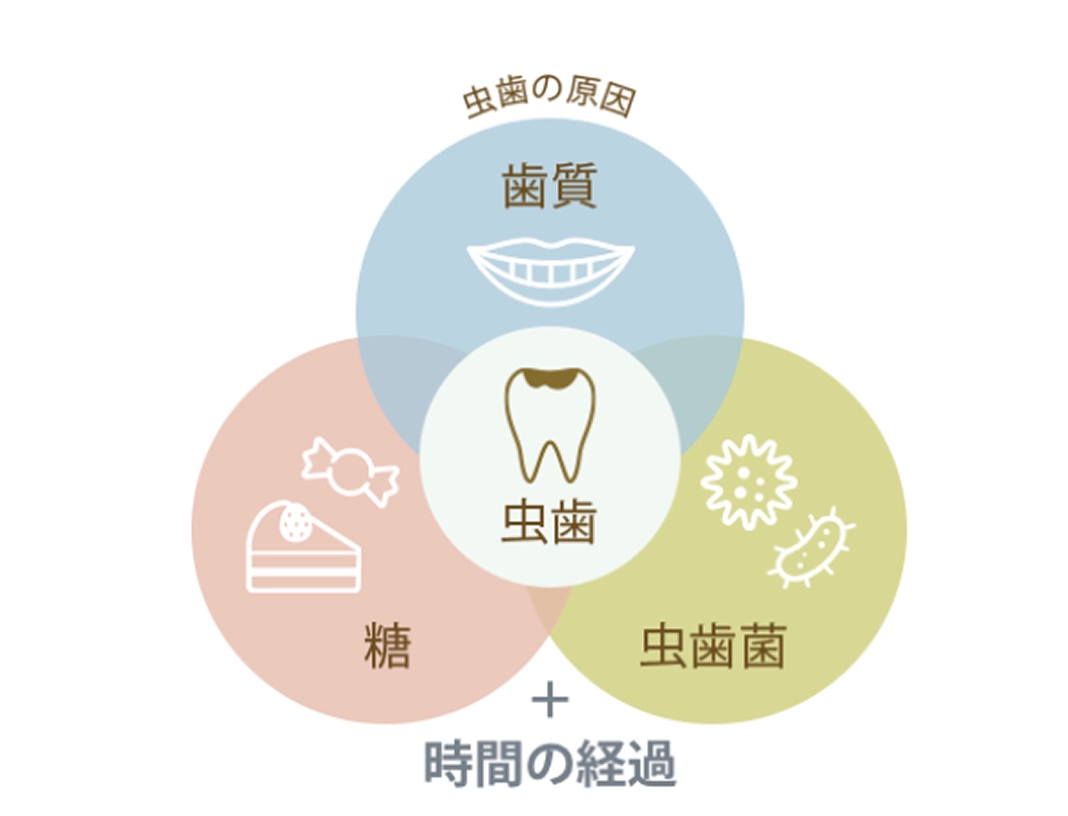 予防のポイント