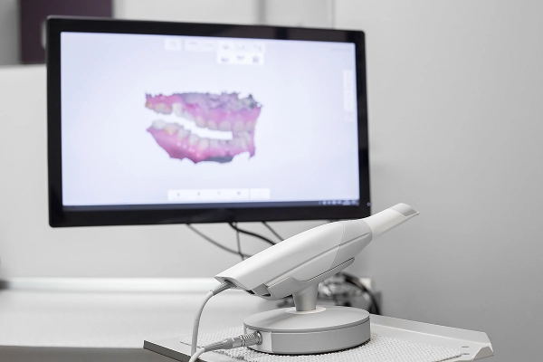 口腔内スキャナー（IOS)による顎運動データの活用