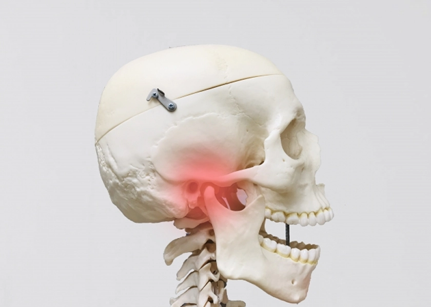 顎関節トラブル