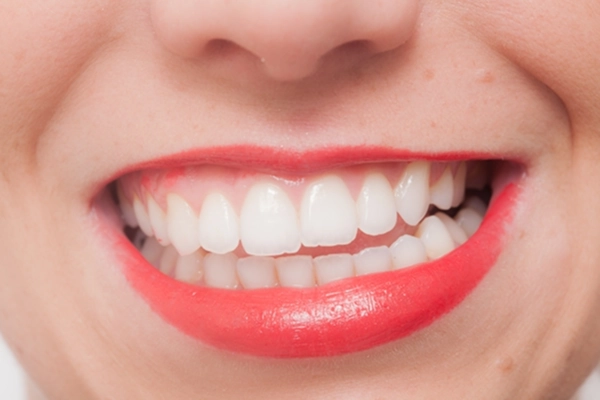 食いしばり・歯ぎしりを生活面から改善